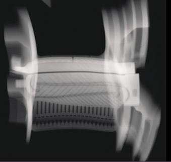 aluminum material tested by xray